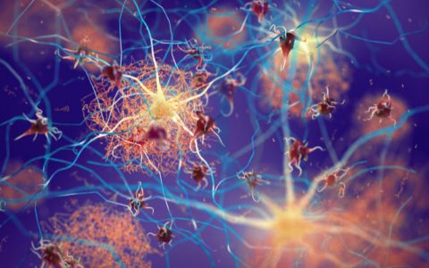 NeuroMetrix 在新的纤维肌痛治疗中飙升 107%